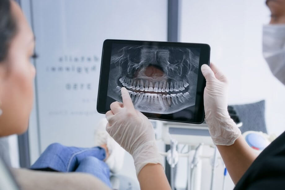 Scaling and root planing treatment for periodontal gum disease