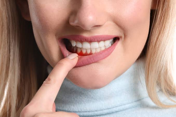 Dental care and gum health education
